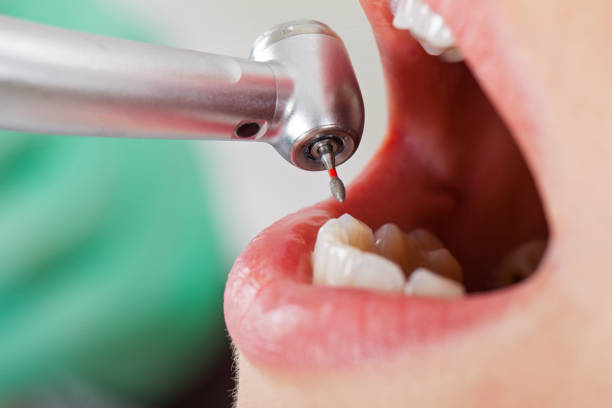 Best Emergency Broken Tooth Repair in Pensacola Station, FL